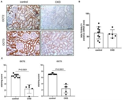 The Role of NF-kB in the Downregulation of Organic Cation Transporter 2 Expression and Renal Cation Secretion in Kidney Disease